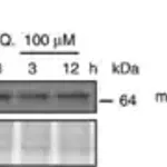 Merck Anti-TFE3 antibody produced in rabbit
