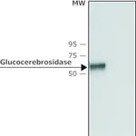 Merck Anti-Glucocerebrosidase (C-terminal) antibody produced in rabbit