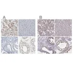 Merck Anti-PKP2 antibody produced in rabbit