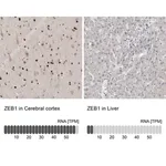 Merck Anti-ZEB1 antibody produced in rabbit