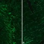 Merck Monoclonal Anti-Neurofilament 200 antibody produced in mouse