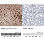 Merck Monoclonal Anti-S100B antibody produced in mouse