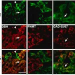 Merck Anti-Glutamic Acid Decarboxylase 65/67 antibody produced in rabbit