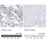 Merck Anti-SFTPC antibody produced in rabbit