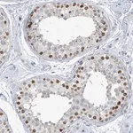 Merck Anti-KMT2D antibody produced in rabbit