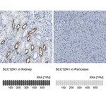 Merck Anti-SLC12A1 antibody produced in rabbit