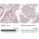 Merck Anti-PRAME antibody produced in rabbit