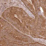 Merck Anti-GSPT1 antibody produced in rabbit