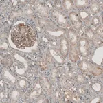 Merck Anti-THSD7A antibody produced in rabbit