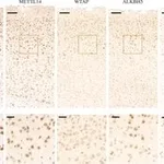 Merck Anti-ALKBH5 antibody produced in rabbit