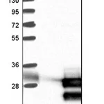 Merck Anti-TCF21 antibody produced in rabbit