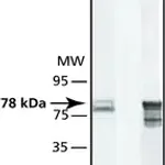 Merck Anti-GRP78/BiP (ET-21) antibody produced in rabbit