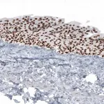 Merck Anti-GRHL2 antibody produced in rabbit