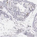 Merck Anti-CDKL5 antibody produced in rabbit