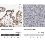 Merck Anti-RARB antibody produced in rabbit