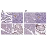 Merck Anti-IGF2BP1 antibody produced in rabbit