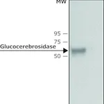 Merck Anti-Glucocerebrosidase antibody produced in rabbit