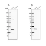 Merck Anti-CRP antibody produced in rabbit