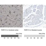 Merck Anti-P2RY12 antibody produced in rabbit