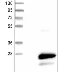 Merck Anti-CMTM6 antibody produced in rabbit