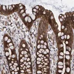 Merck Anti-LRBA antibody produced in rabbit