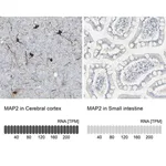 Merck Anti-MAP2 antibody produced in rabbit