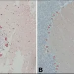 Merck Anti-Calbindin-D-28K (EG-20) antibody produced in rabbit