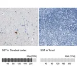 Merck Anti-SST antibody produced in rabbit