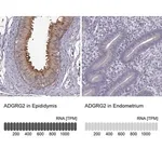 Merck Anti-ADGRG2 antibody produced in rabbit
