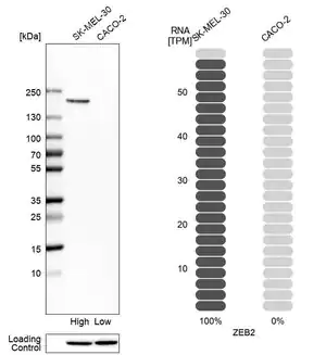 Merck Anti-ZEB2 antibody produced in rabbit