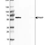 Merck Anti-PNKP antibody produced in rabbit
