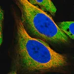 Merck Anti-MCOLN1 antibody produced in rabbit