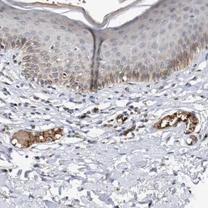 Merck Anti-CCL2 antibody produced in rabbit