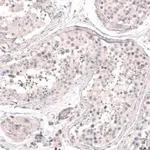 Merck Anti-SMC6 antibody produced in rabbit