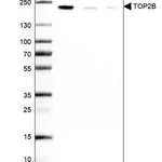 Merck Anti-TOP2B antibody produced in rabbit
