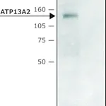 Merck Anti-ATP13A2 (C-terminal region) antibody produced in rabbit