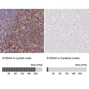 Merck Anti-S100A4 antibody produced in rabbit