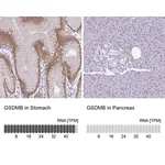Merck Anti-GSDMB antibody produced in rabbit