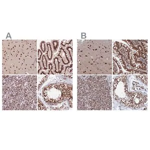 Merck Anti-CTB-50L17.10 antibody produced in rabbit