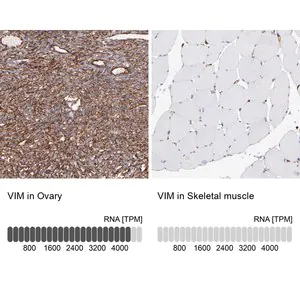 Merck Anti-VIM antibody produced in rabbit