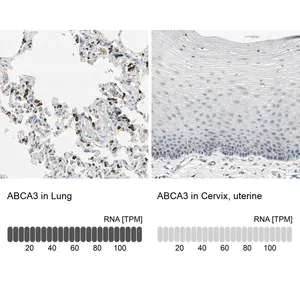 Merck Anti-ABCA3 antibody produced in rabbit