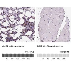 Merck Anti-MMP9 antibody produced in rabbit