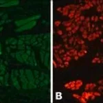 Merck Anti-Myosin (Skeletal) antibody produced in rabbit