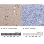 Merck Anti-ALDOC antibody produced in rabbit