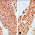 Merck Anti-Guanylyl Cyclase β1 (ER-19) antibody produced in rabbit