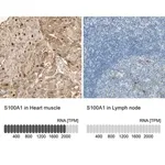 Merck Anti-S100A1 antibody produced in rabbit