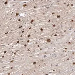 Merck Anti-TBX5 antibody produced in rabbit