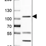 Merck Anti-UBE3A antibody produced in rabbit