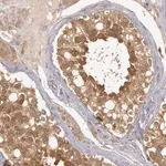 Merck Anti-BRAF antibody produced in rabbit