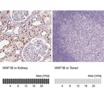 Merck Monoclonal Anti-HNF1B antibody produced in mouse